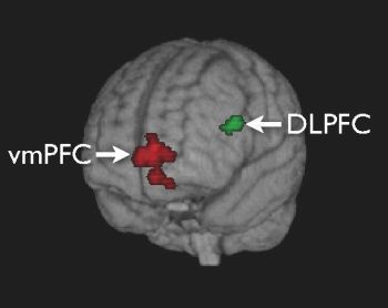 transparent brain shows regions of activation ventral medial prefrontal cortex vmPFC dorsolateral prefrontal cortex